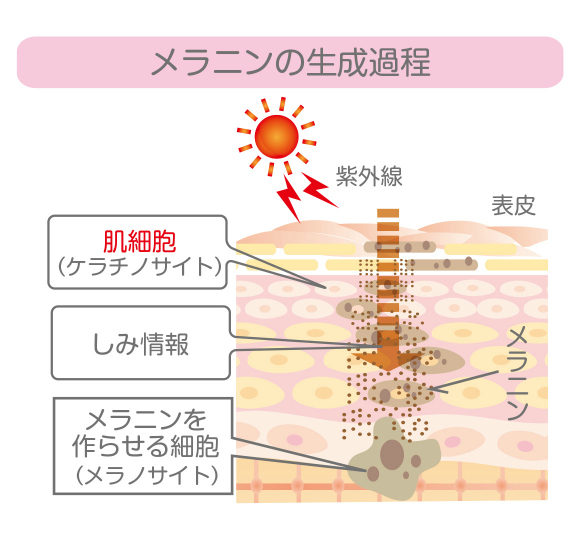 胸元にできるシミの原因と対策 | イヴの憂鬱